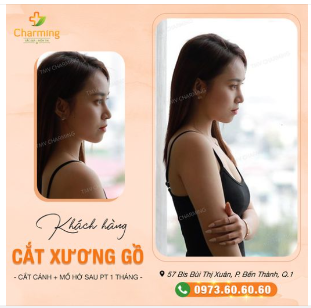 Nàng khách thì đăm chiêu nhìn cửa sổ, còn Charming thì thơ thẫn nhìn nàng.