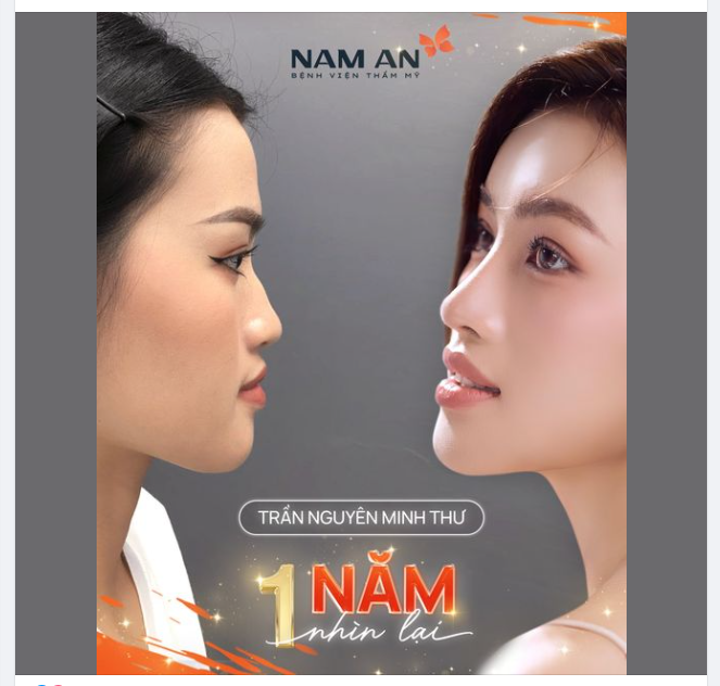 NHÌN LẠI DÁNG MŨI 1 NĂM