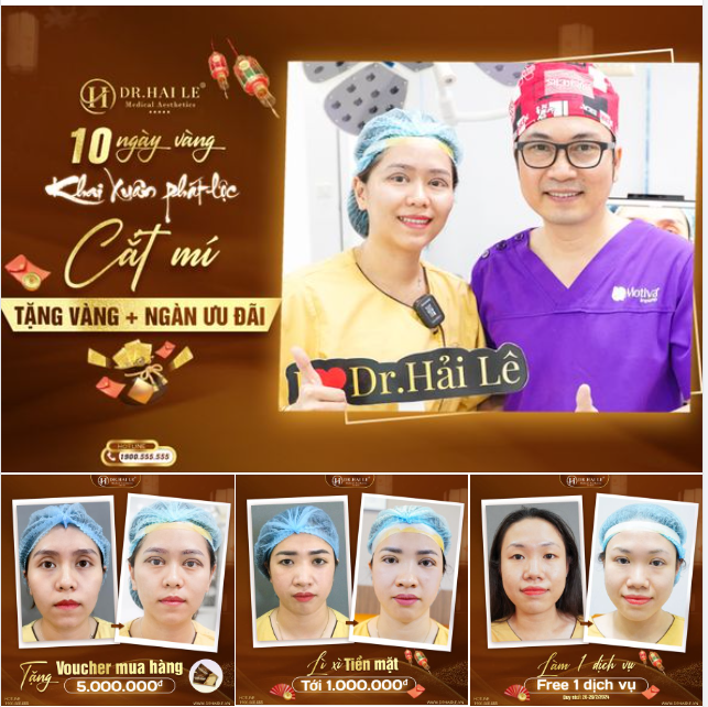 Bạn đang tìm kiếm một địa chỉ thẩm mỹ uy tín giúp mình sở hữu cặp mắt 2 mí xinh duyên?