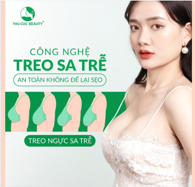 Công nghệ treo sa trễ