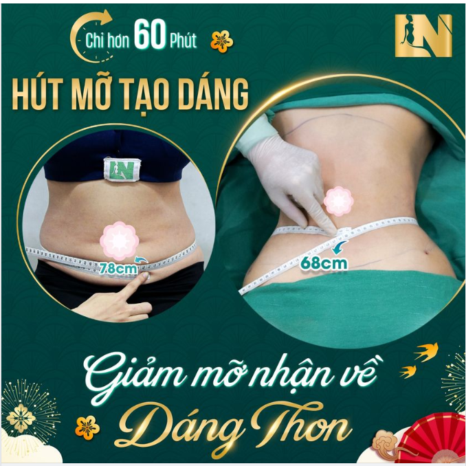 GIẢM MỠ AN TOÀN ĐỂ SỞ HỮU VÒNG EO THON GỌN THẮT ĐÁY