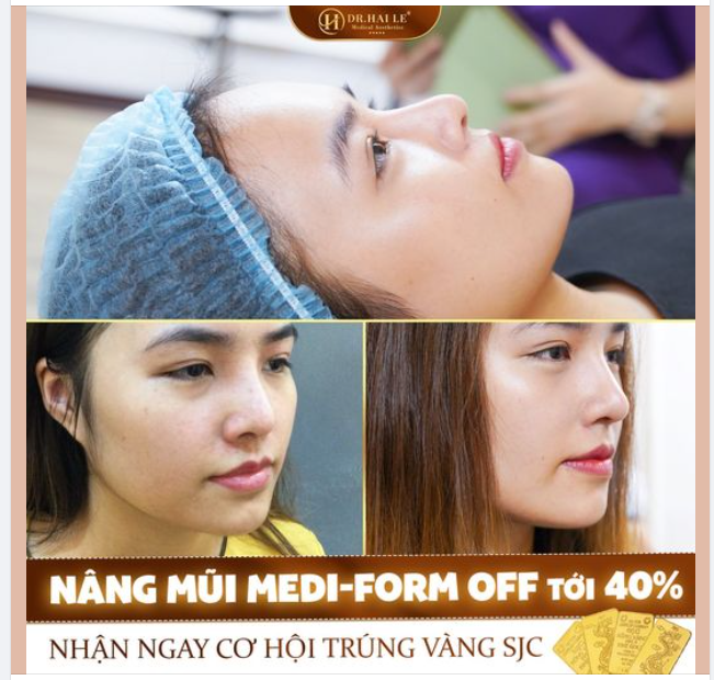 Đến Dr.Hải Lê Sài Gòn nâng mũi Medi-form trong tháng 2 này, bạn không chỉ được giảm giá siêu sâu mà còn tặng kèm nhiều ưu đãi