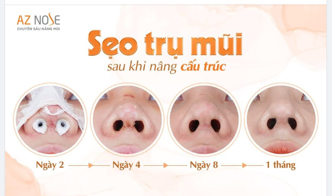 Ở đây chúng tôi có SẸO ĐẸP