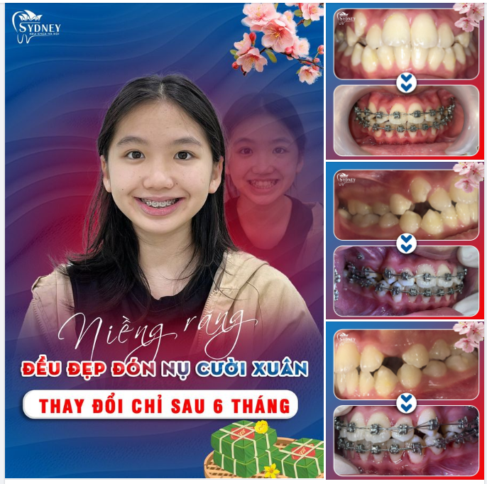 HẾT KHẤP KHỂNH, ĐỀU ĐẸP ĐÓN NỤ CƯỜI XUÂN