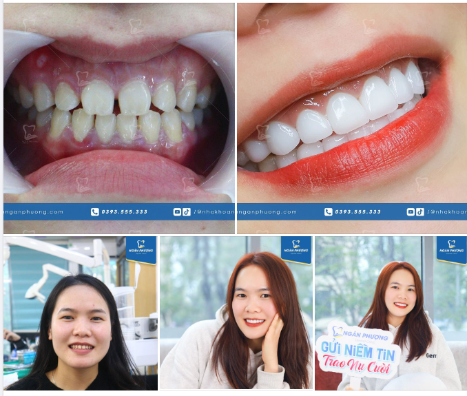 Gửi niềm tin - Trao nụ cười