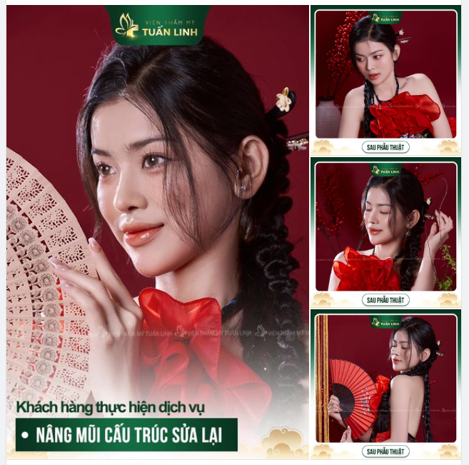 MŨI CẤU TRÚC SỬA LẠI ĐẸP HOÀN HẢO ĐẾN TỪNG CHI TIẾT!!!
