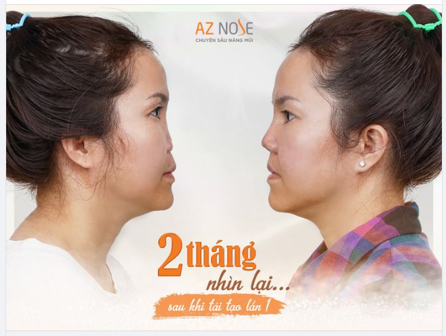 Đây KHÔNG PHẢI là hình Photoshop.