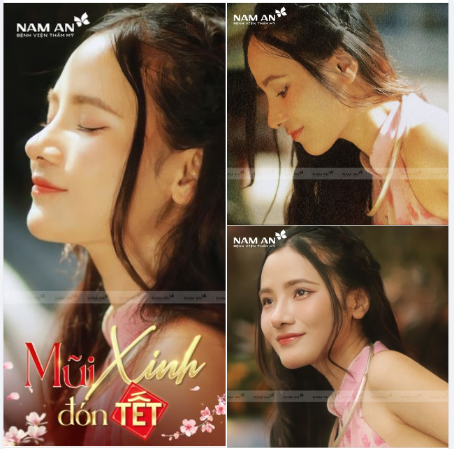 MŨI XINH TỰ TIN THẢ DÁNG
