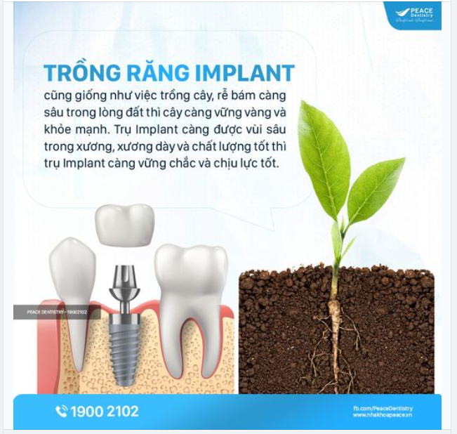 TRỒNG RĂNG IMPLANT VÀO THỜI ĐIỂM NÀO LÀ LÝ TƯỞNG?