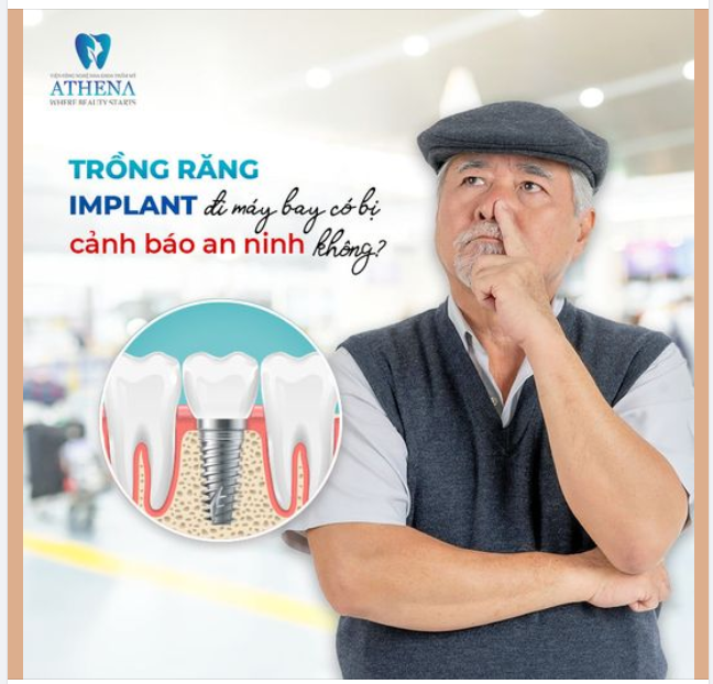 TRỒNG RĂNG IMPLANT CÓ BỊ CẢNH BÁO AN NINH KHI ĐI MÁY BAY KHÔNG?