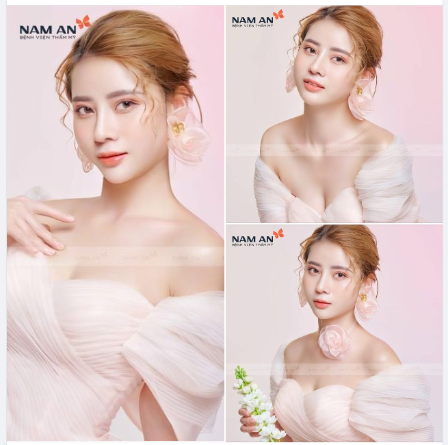 NHÂN ĐÔI XINH ĐẸP - MŨI MÍ 1 NĂM