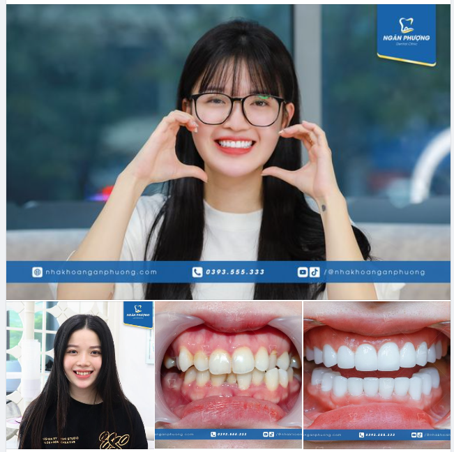 Đến bác sĩ cũng không nhận ra vì sau hơn 1 năm, Thục Trinh đã có màn thay đổi ngoàn mục chỉ nhờ làm răng