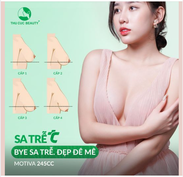 Nâng ngực hồi phục nhanh X2 sau 07 ngày Khuôn ngực tròn đầy, mềm mại