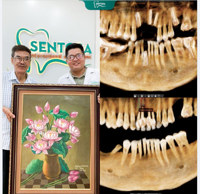Nỗi nguy hiểm khi ba mẹ lớn tuổi mất răng!!!