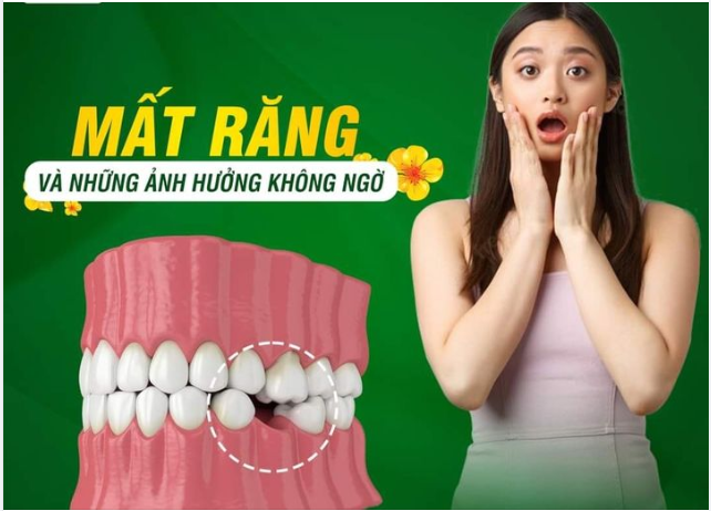 MẤT RĂNG VÀ NHỮNG ẢNH HƯỞNG KHÔNG NGỜ