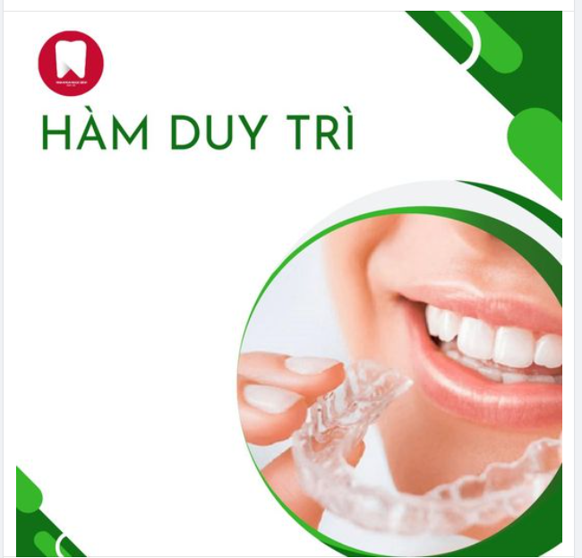 Sau một thời gian niềng răng, bệnh nhân sẽ có được kết quả như mong đợi. Tuy nhiên, nhiều người đã vội vui mừng và quên mất việc phải gắn một loại khí cụ lên sau khi niềng răng đó là hàm duy trì.