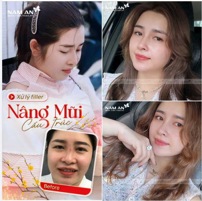 MŨI CAO THANH THOÁT