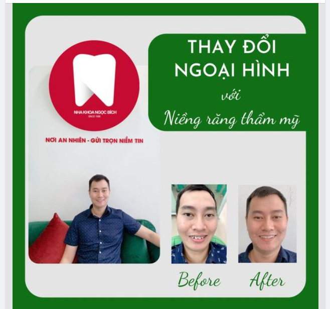 THĂNG HẠNG NHAN SẮC SAU KHI NIỀNG RĂNG - TẤT CẢ PHỤ THUỘC VÀO ĐỊA CHỈ NHA KHOA MÀ BẠN CHỌN