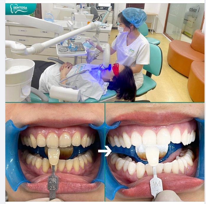 Lên 2 tone tự nhiên với giá ưu đãi ngày cuối cùng tại Sentosa!