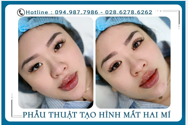 Bạn có tin sự thay đổi hoàn hảo này chỉ trong vòng 15 phút phẫu thuật 
