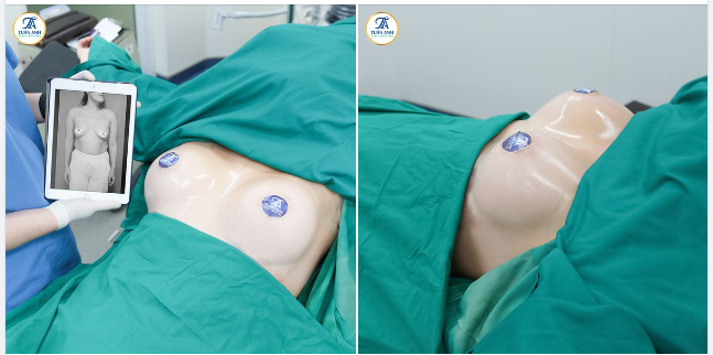 Bác sĩ Tuấn Anh CKI với hơn 16 năm kinh nghiệm - Top đầu ngành phẫu thuật thẩm mỹ sẽ giúp bạn sở hữu: