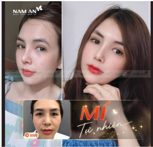 THAY ĐỔI NẾP MÍ - KHÍ SẮC TĂNG CAO