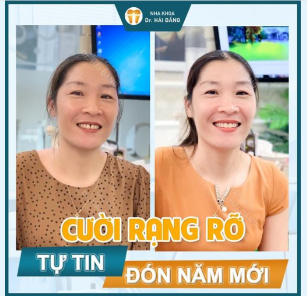 CƯỜI RẠNG RỠ TỰ TIN ĐÓN NĂM MỚI
