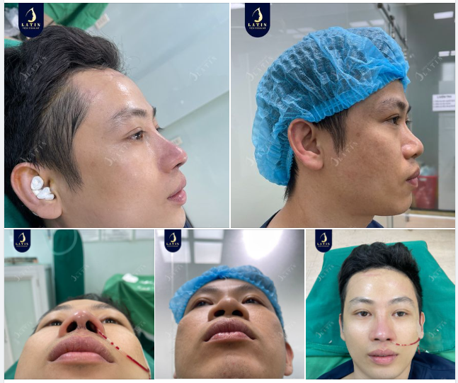 Nam giới thì sao phải làm đẹp làm gì