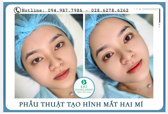 Đầu năm rạng rỡ cùng đôi mắt xinh