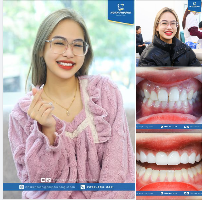 Ngoài rạp có mai có đào, Nha khoa Ngân Phượng có nụ cười ngọt ngào của Yến Ly