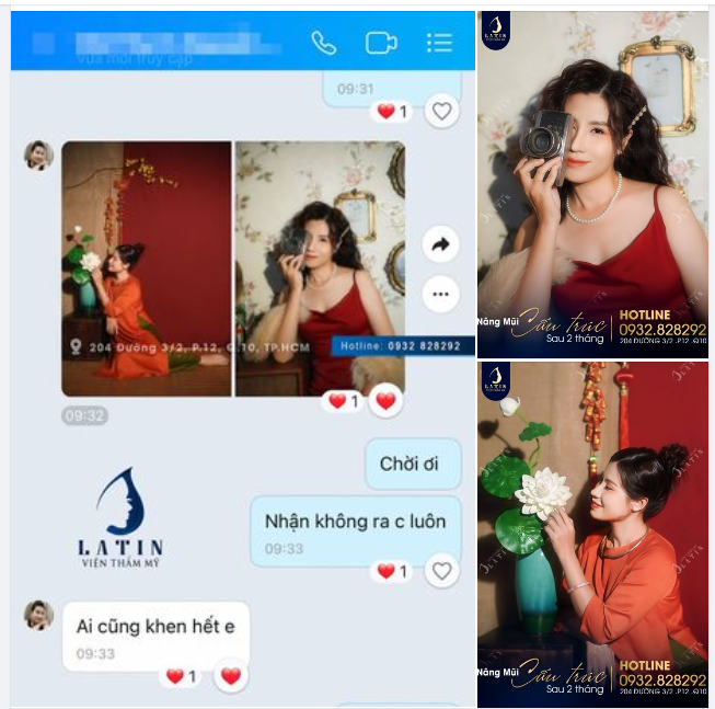 BIẾN HÌNH MŨI XINH - TỰ TIN TỎA SÁNG