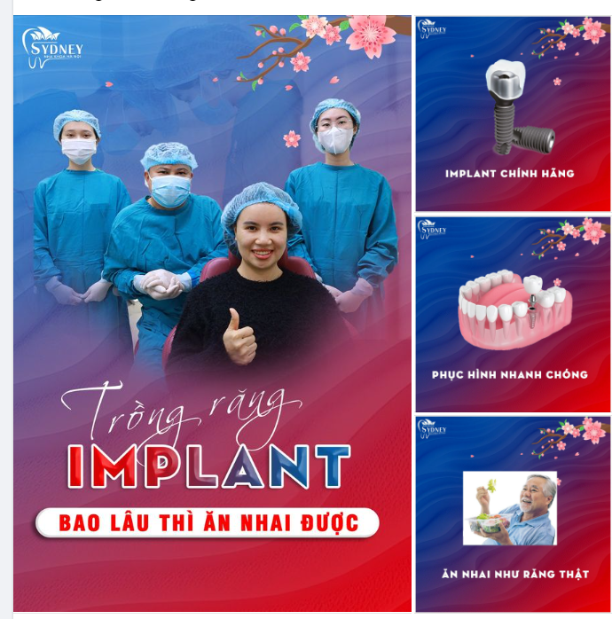 TRỒNG RĂNG IMPLANT BAO LÂU THÌ ĂN ĐƯỢC?