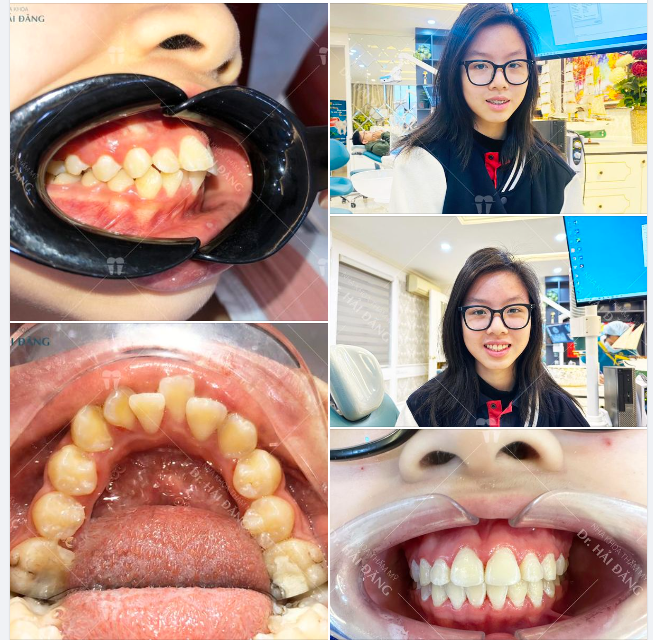 TẠM BIỆT MẮC CÀI - ĐÓN TẾT NHƯ Ý
