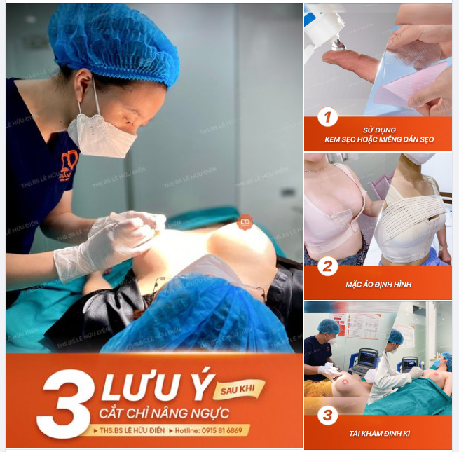 3 LƯU Ý QUAN TRỌNG SAU KHI CẮT CHỈ NGỰC