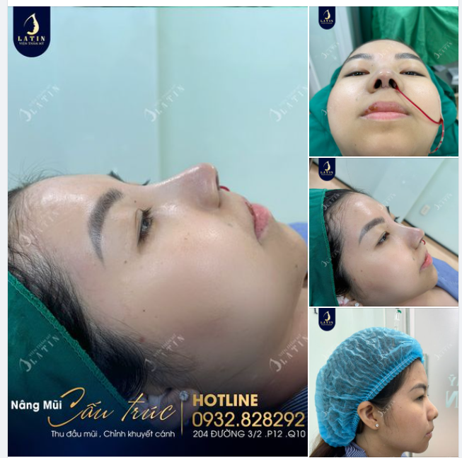 Xuân đã về, tô điểm nhan sắc thêm xinh với dáng mũi cao nét tự nhiên những vẫn hợp mặt cho em gái.