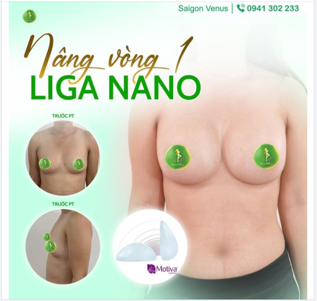 NÂNG V1 LIGA NANO SIÊU HOT TẠI SAIGON VENUS