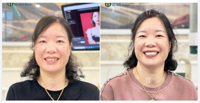NỤ CƯỜI RẠNG RỠ - ĐÓN TẾT XINH TƯƠI