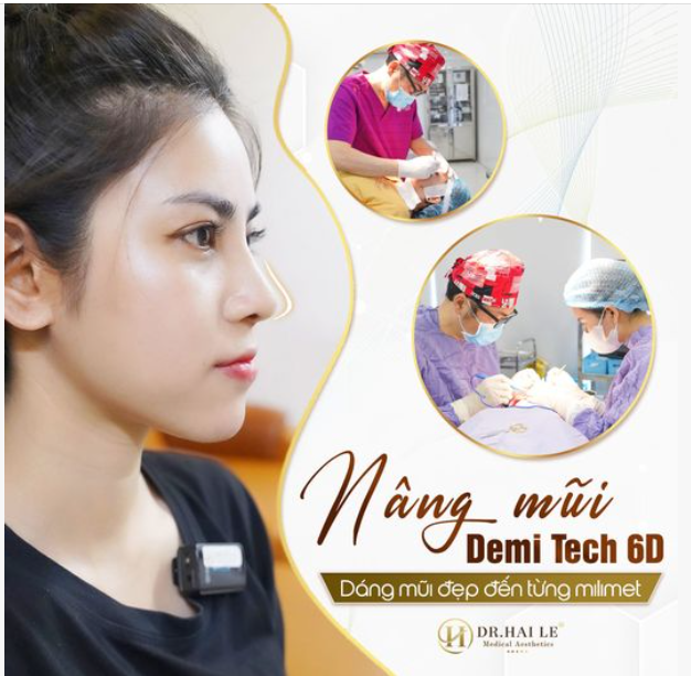 Nâng mũi Demi Tech 6D có gì mà sau bao năm vẫn HOT như vậy