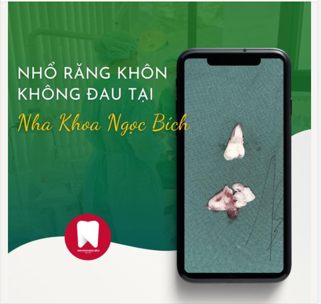 XÓA SỔ RĂNG KHÔN MỌC “DẠI”