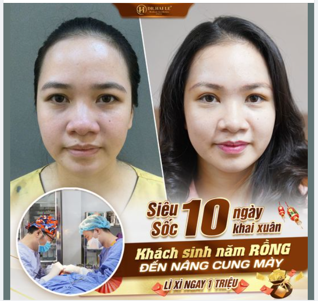 Bạn không nghe nhầm đâu ạ. Tháng 2 này, Dr.Hải Lê Sài Gòn chơi lớn tặng chị em loạt ưu đãi khủng!