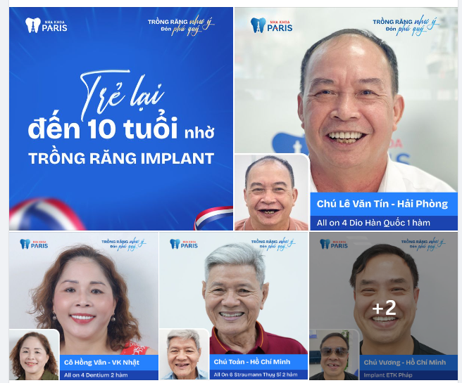 Những hình ảnh thay đổi tuyệt vời của Cô, Chú sau trồng răng implant ALL ON 