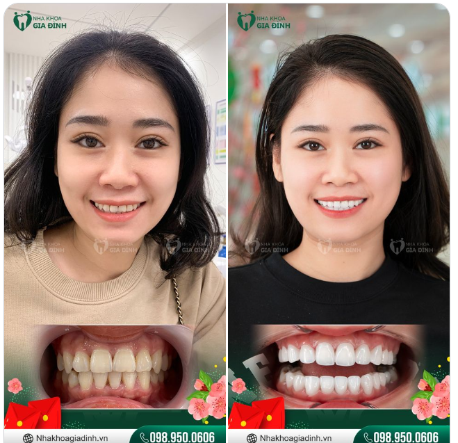 THẦN THÁI KHÁC BIỆT CHỈ KHI LÀM RĂNG SỨ BẠN MỚI NHẬN RA