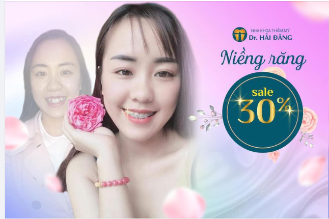 ƯU ĐÃI NIỀNG RĂNG DỊP TẾT