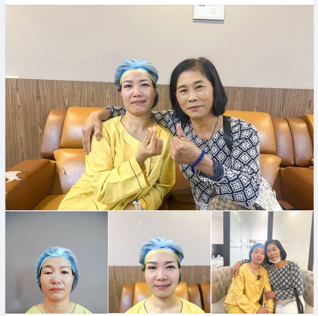 “Đẹp quá rồi , con yêu của mẹ!” Trong số những ca phẫu thuật ngày hôm nay, Dr.Hải Lê ấn tượng nhất với một ca chỉnh hình mí bệnh lý bẩm sinh bởi câu chuyện chị chia sẻ…
