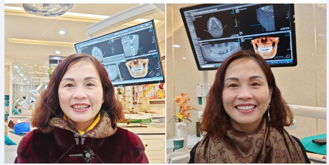 THAY ĐỔI NỤ CƯỜI HƯƠNG SẮC XUÂN