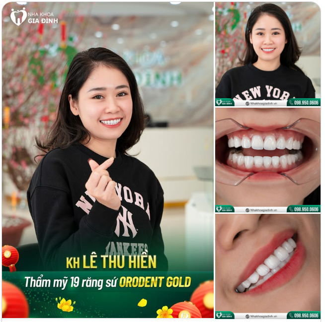 GIỮA MUÔN VÀN LỰA CHỌN, CÁM ƠN BẠN VÌ ĐÃ TIN TƯỞNG NHA KHOA GIA ĐÌNH