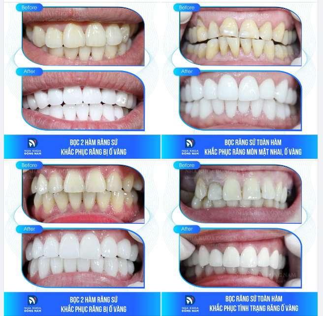 CHÀO NĂM MỚI VỚI NỤ CƯỜI MỚI, ĐÓN NHẬN THẬT NHIỀU MAY MẮN