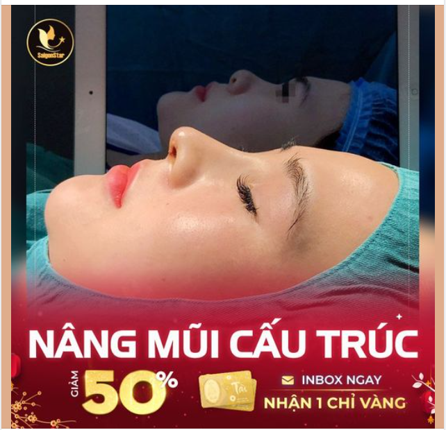 NGÀY CUỐI: NÂNG MŨI CẤU TRÚC GIẢM 50%