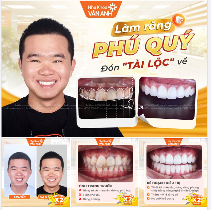 LÀM RĂNG PHÚ QUÝ - VẠN SỰ NHƯ Ý