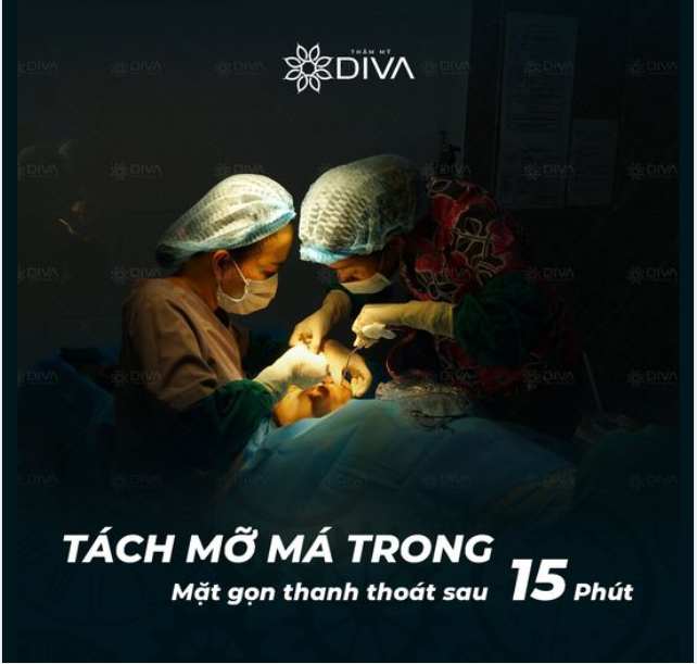 TÁCH MỠ MÁ TRONG – MẶT GỌN, THANH THOÁT SAU 15 PHÚT